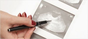 prowadzenie ciąży II trymestr